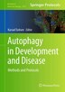 Autophagy in Development and Disease by Kursad Turksen, Hardcover | Indigo Chapters