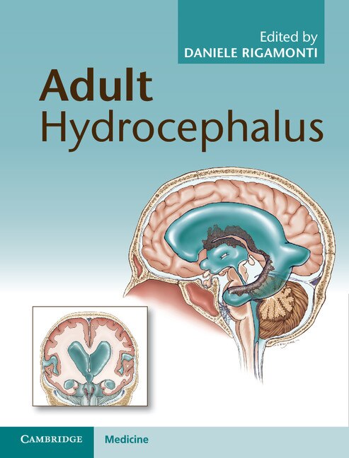 Adult Hydrocephalus by Daniele Rigamonti, Hardcover | Indigo Chapters
