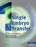 Single Embryo Transfer by Jan Gerris, Paperback | Indigo Chapters