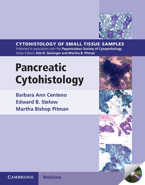 Pancreatic Cytohistology by Barbara Ann Centeno, Boxed Set/Slip Case/Casebound | Indigo Chapters