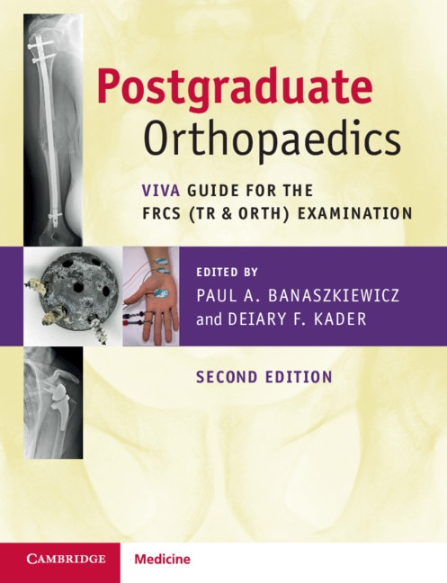 Postgraduate Orthopaedics by Paul A. Banaszkiewicz, Paperback | Indigo Chapters