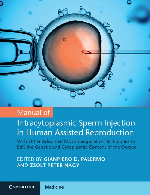 Manual of Intracytoplasmic Sperm Injection in Human Assisted Reproduction by Gianpiero D. Palermo, Paperback | Indigo Chapters