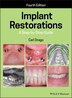 Implant Restorations by Carl Drago, Hardcover | Indigo Chapters