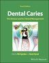 Dental Caries by Ole Fejerskov, Hardcover | Indigo Chapters