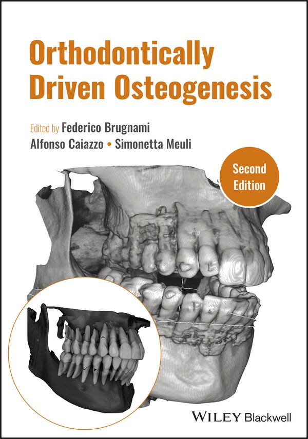 Orthodontically Driven Osteogenesis by Federico Brugnami, Hardcover | Indigo Chapters
