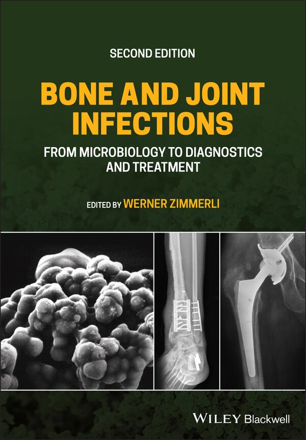 Bone And Joint Infections by Werner Zimmerli, Hardcover | Indigo Chapters