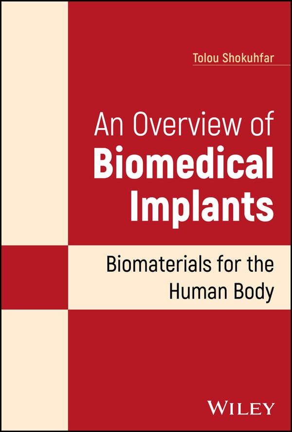 An Overview of Biomedical Implants by Tolou Shokuhfar, Hardcover | Indigo Chapters