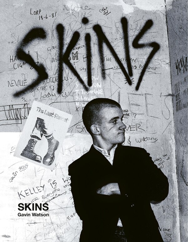 Skins by Gavin Watson, Hardcover | Indigo Chapters