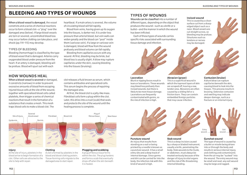 Sample content 2_ACEP First Aid Manual