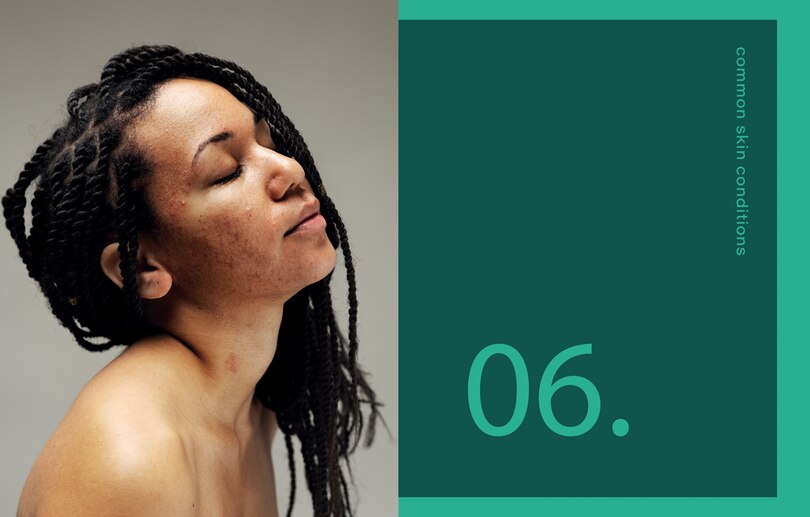 Sample content 2_Black Skin: The definitive skincare guide