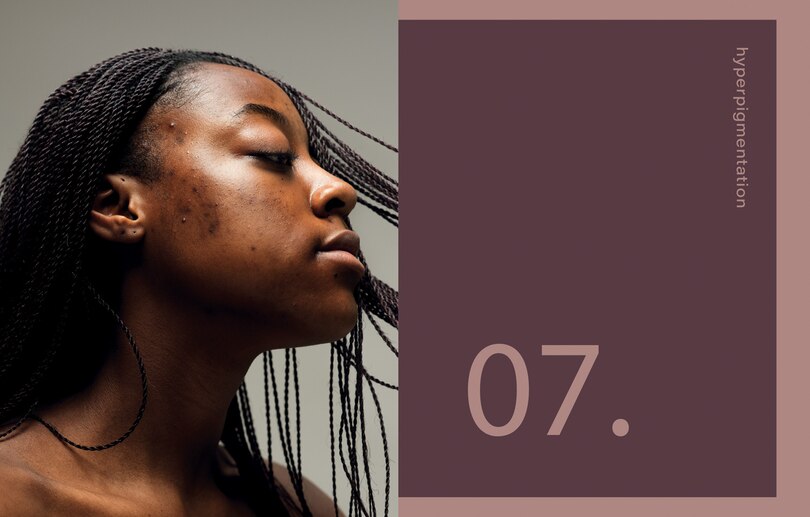 Sample content 3_Black Skin: The definitive skincare guide