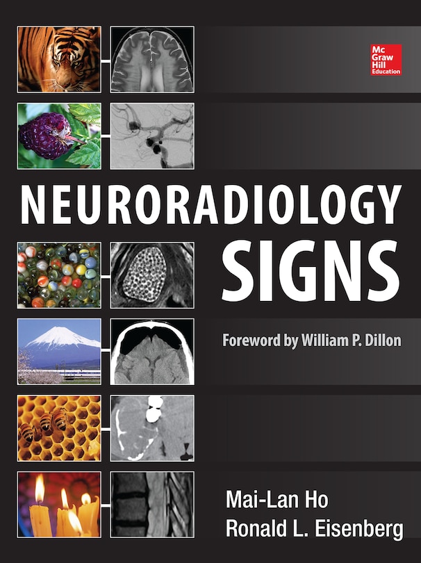 Couverture_Neuroradiology Signs