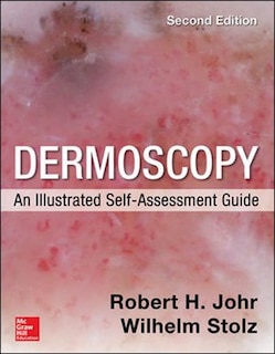 Front cover_Dermoscopy: An Illustrated Self-Assessment Guide, 2/e