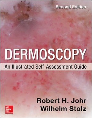Front cover_Dermoscopy: An Illustrated Self-Assessment Guide, 2/e
