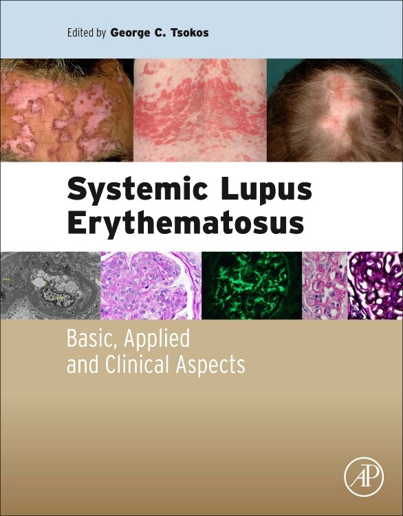 Front cover_Systemic Lupus Erythematosus