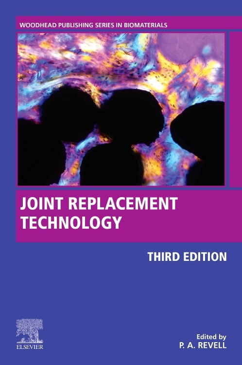 Front cover_Joint Replacement Technology