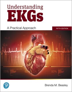 Front cover_Understanding Ekgs