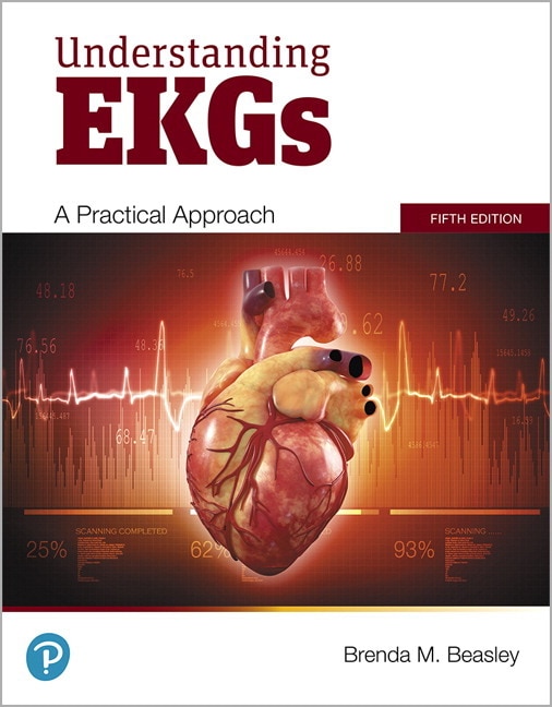 Front cover_Understanding Ekgs