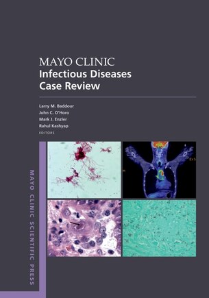 Mayo Clinic Infectious Disease Case Review: With Board-style Questions And Answers