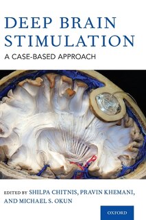 Front cover_Deep Brain Stimulation