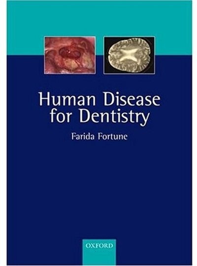 Front cover_Human Disease For Dentistry