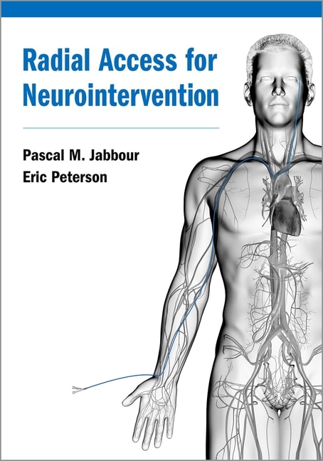 Couverture_Radial Access For Neurointervention