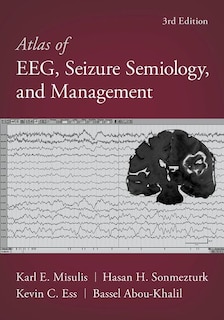 Front cover_Atlas of EEG, Seizure Semiology, and Management