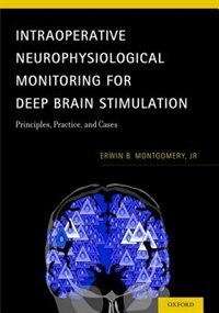 Front cover_Intraoperative Neurophysiological Monitoring for Deep Brain Stimulation