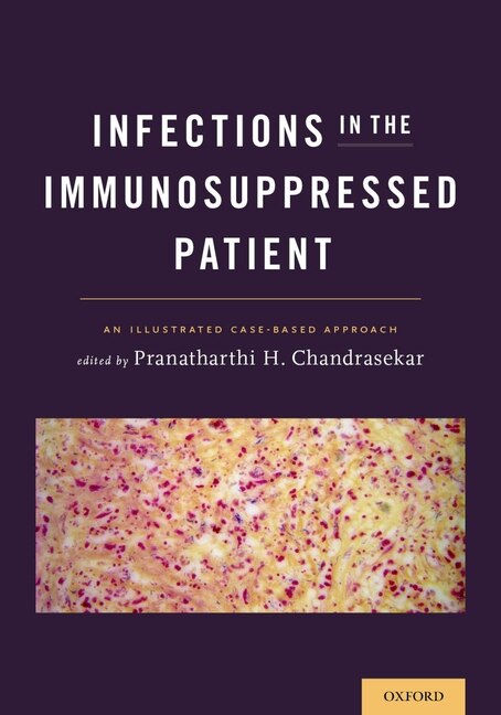 Front cover_Infections in the Immunosuppressed Patient