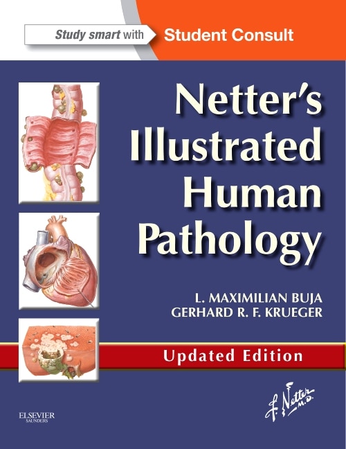 Front cover_Netter's Illustrated Human Pathology Updated Edition