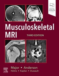 Front cover_Musculoskeletal Mri