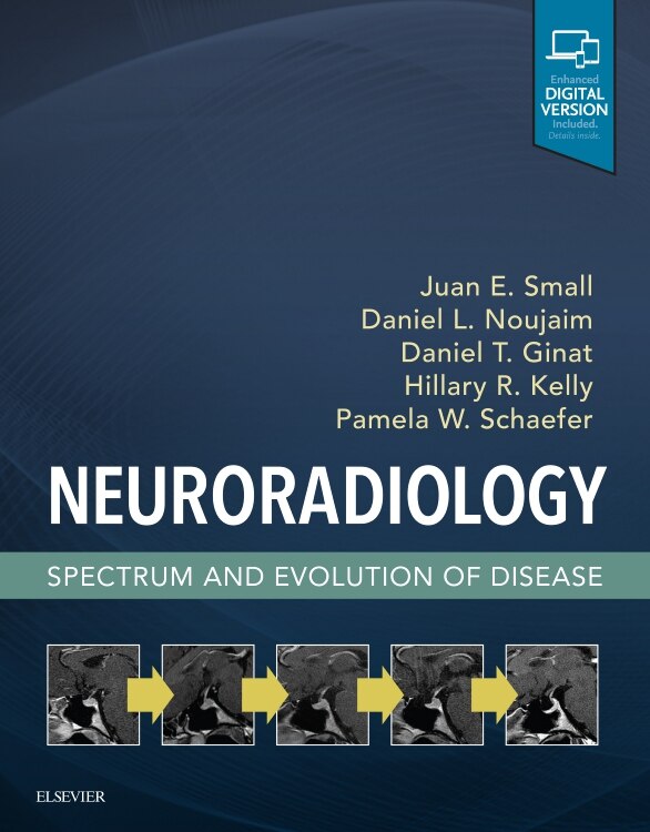 Couverture_Neuroradiology