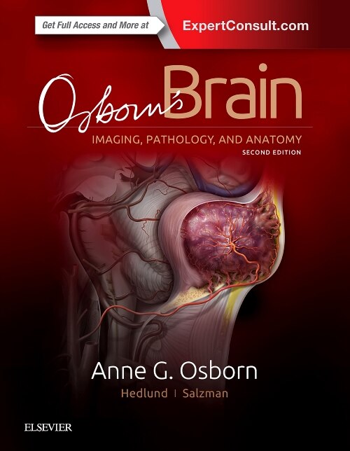 Front cover_Osborn's Brain