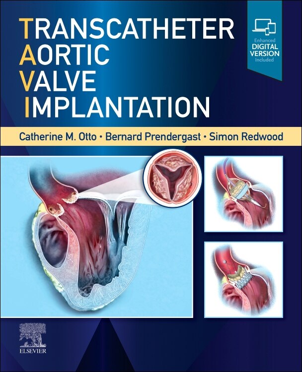 Couverture_Transcatheter Aortic Valve Implantation