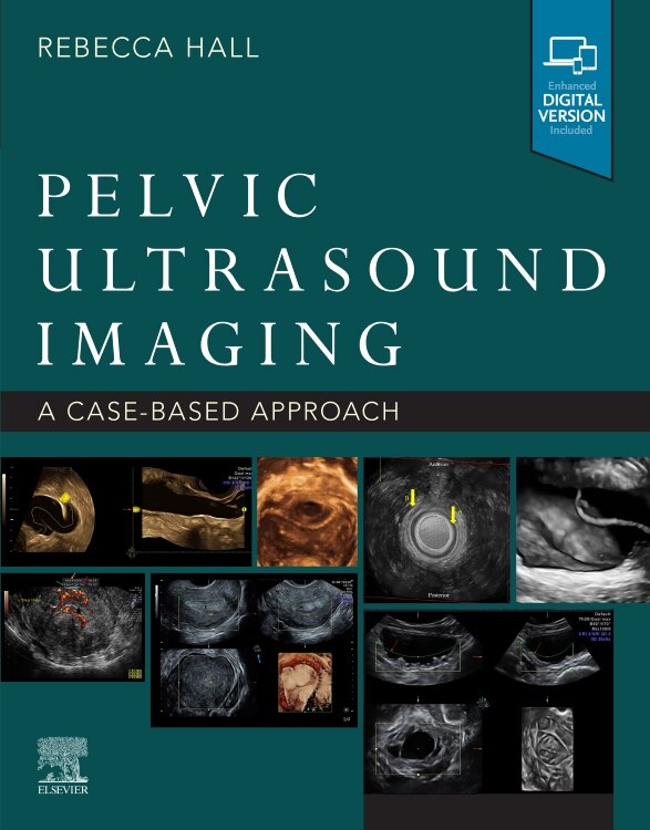 Front cover_Pelvic Ultrasound Imaging