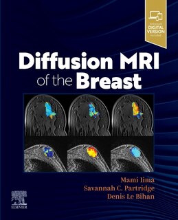 Couverture_Diffusion Mri Of The Breast