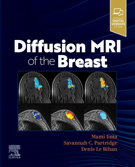 Couverture_Diffusion Mri Of The Breast