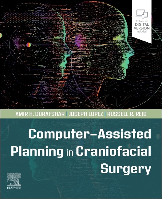 Front cover_Computer-Assisted Planning in Craniofacial Surgery