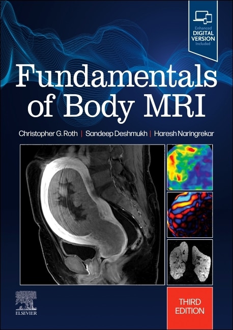 Front cover_Fundamentals of Body MRI