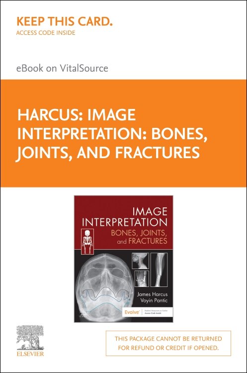 Image Interpretation: Bones, Joints, and Fractures -Elsevier E-Book on VitalSource (Retail Access Card): Image Interpretation: Bones, Joints, and Fractures -Elsevier E-Book on VitalSource (Retail Access Card), 1e