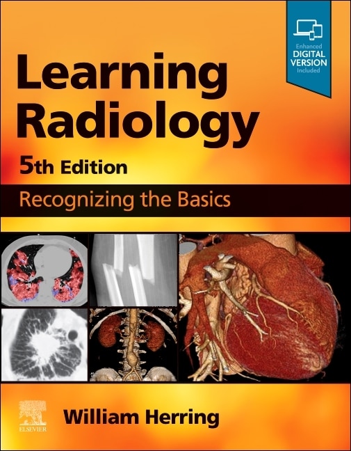 Front cover_Learning Radiology