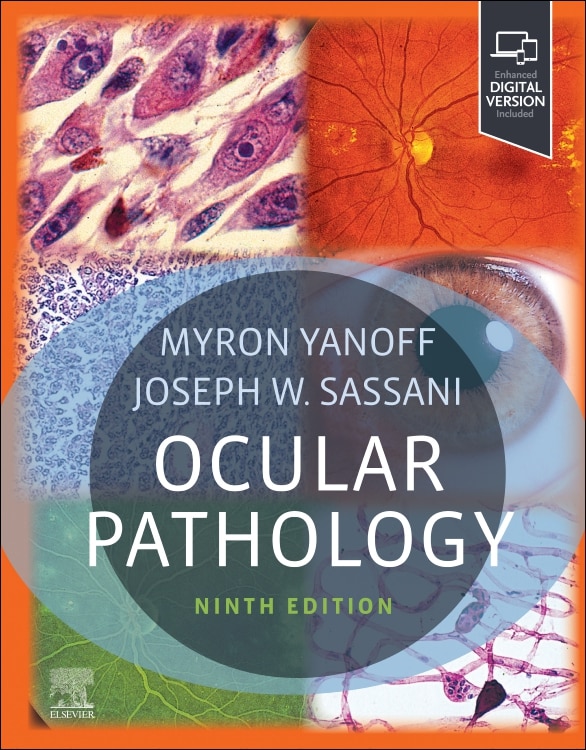 Front cover_Ocular Pathology