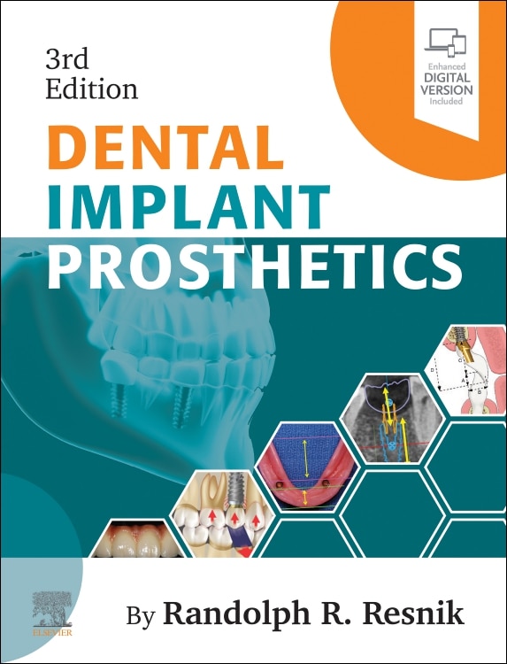 Couverture_Dental Implant Prosthetics