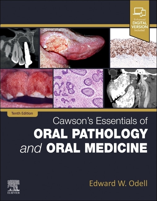 Couverture_Cawson's Essentials of Oral Pathology and Oral Medicine