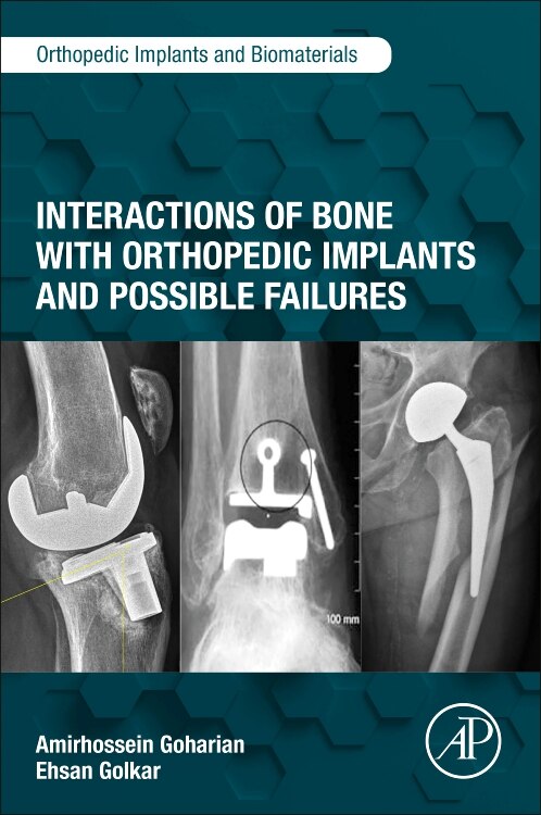 Couverture_Interactions of Bone with Orthopedic Implants and Possible Failures