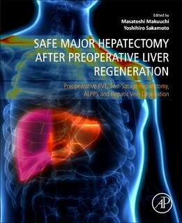 Couverture_Safe Major Hepatectomy after Preoperative Liver Regeneration
