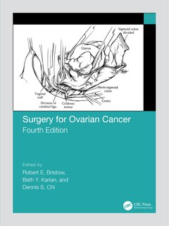 Couverture_Surgery For Ovarian Cancer