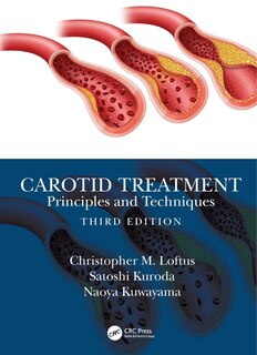 Front cover_Carotid Treatment