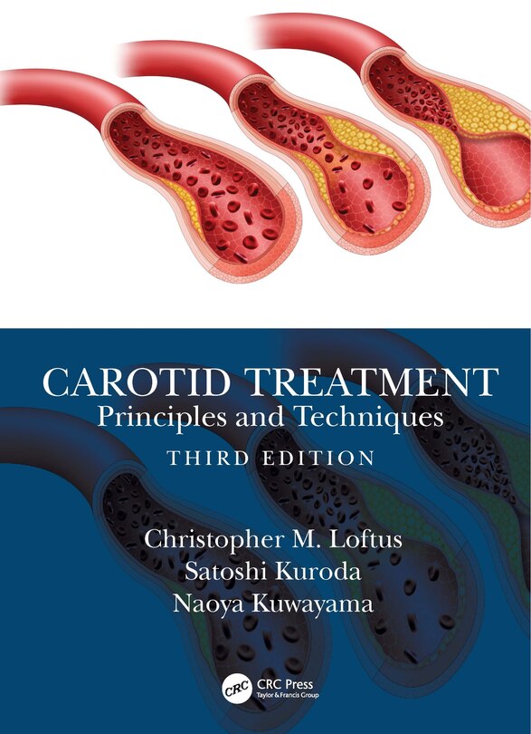 Front cover_Carotid Treatment
