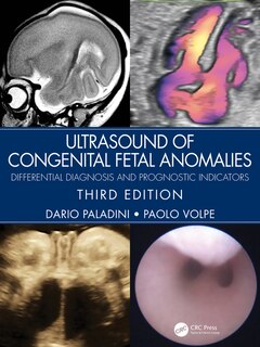 Front cover_Ultrasound of Congenital Fetal Anomalies